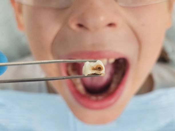 Best Emergency Pediatric Dental Care in Foothill Farms, CA